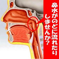 鼻水がのどに流れたりしませんか？　咳がひどい？　喘息と勘違いしないで！